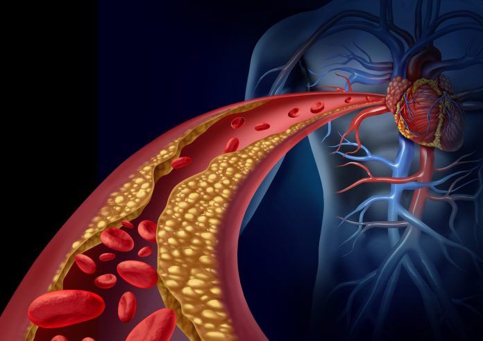 Vegan diets can lower high blood pressure by reducing the plaque accumulation in blood vessels.