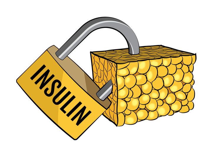 Insulin resistance visualized as a jammed lock preventing glucose from entering muscle cells in type 2 diabetes